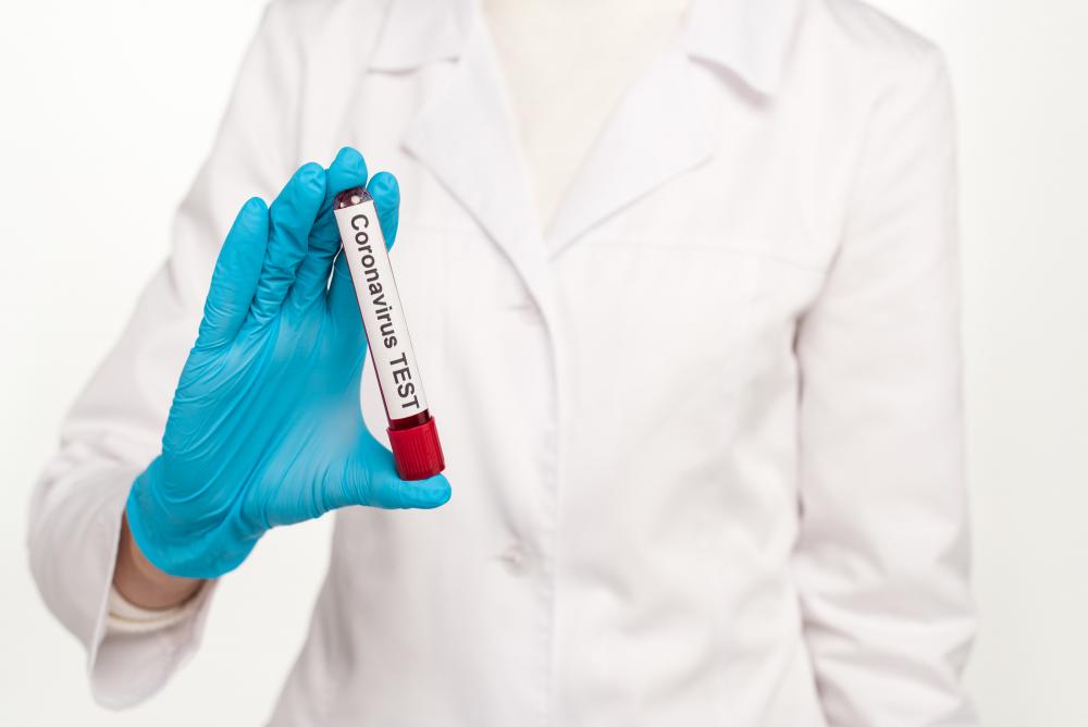 Германия начинает испытания вакцины против коронавируса на людях