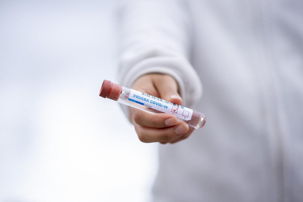 В России разработали первую в мире тест-систему для выявления «британского» штамма коронавируса