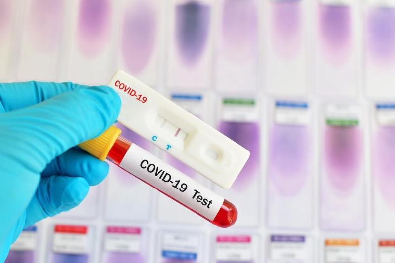 Сколько будут стоить экспресс-тесты на коронавирус в Казахстане