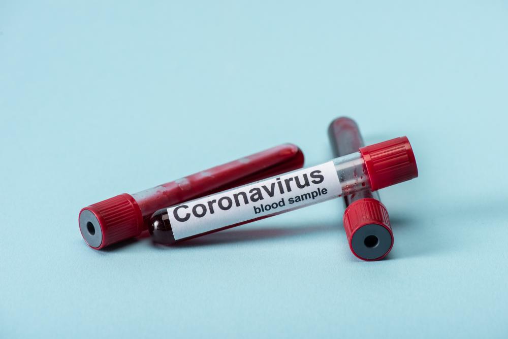 Daily Mail: Создана первая в мире убивающая коронавирус вакцина
